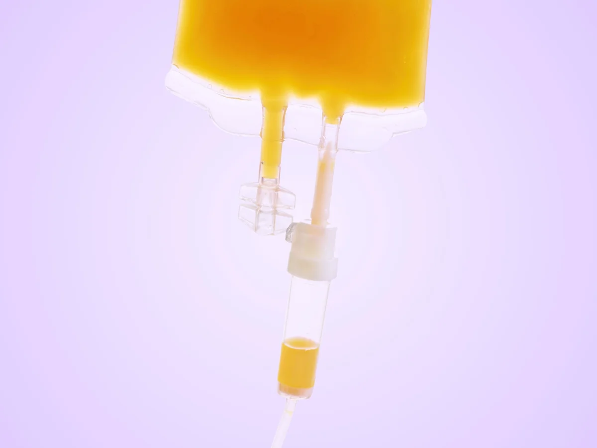 Can Plasma Exchange Offer Insights into Aging and Longevity?