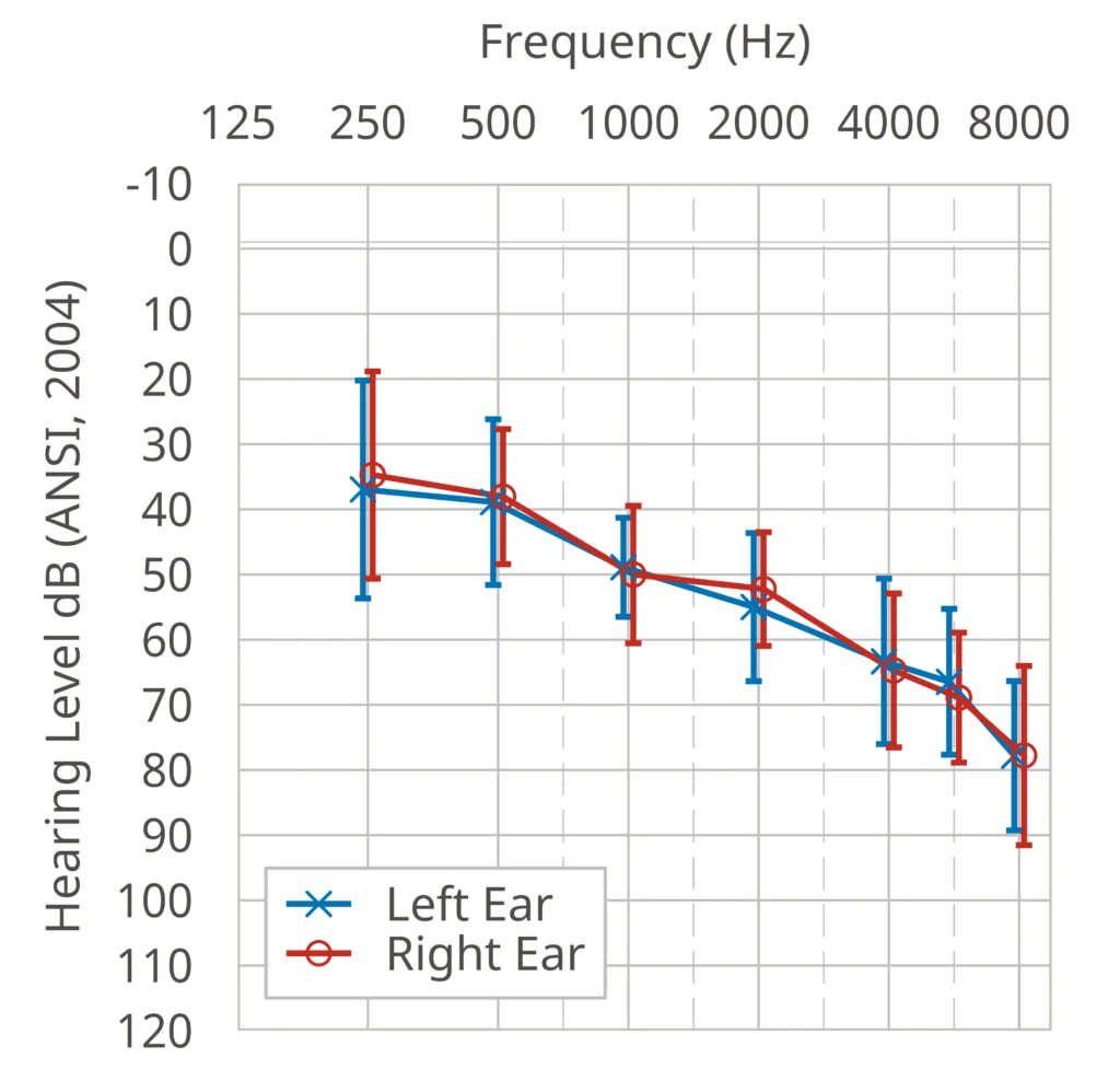 Exploring the Neural Advantages of Clarity Boost AI in Hearing Aids